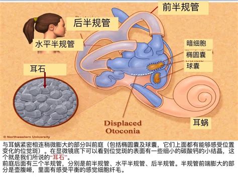 耳石復位法|耳石症自我复位法图解